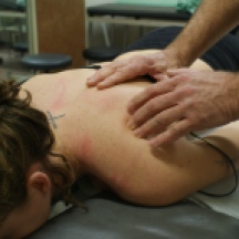 Figure 5.4.4. Identification of trigger point through palpation.