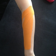 Taping of the forearm