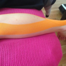 Figure 5.5.3 Taping of the gastrocnemius