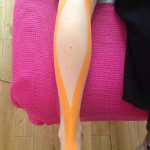 Figure 5.5.2 Kinesio taping the gastrocnemius